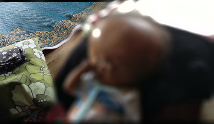  Miris, Bayi di Cianjur Selatan Ini Menderita Hidrosefalus Sejak Lahir